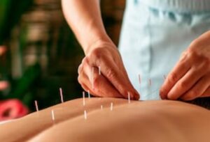 Best Acupuncture Treatment in Phase 2, Ashok Vihar