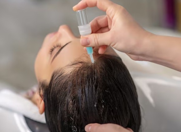 Hair Homeopathy Treatment in Ashok Vihar